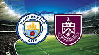 Manchester City x Burnley: Palpite e odds do jogo da Premier League (31/01)